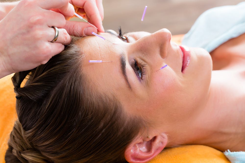 The Point of Acupuncture