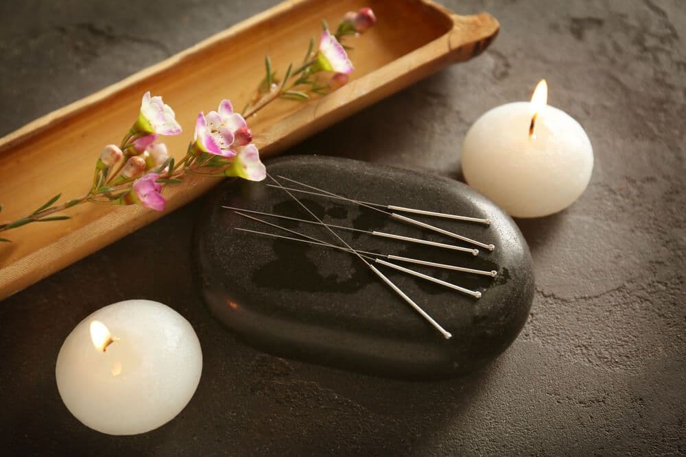 Ask the Experts: What Can Acupuncture Help?